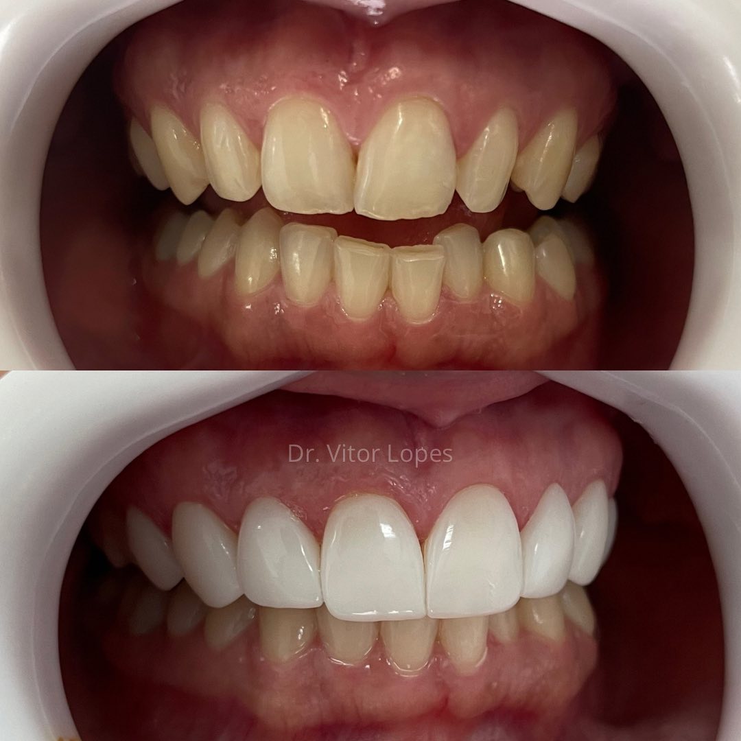 Transformação Estética — antes e depois